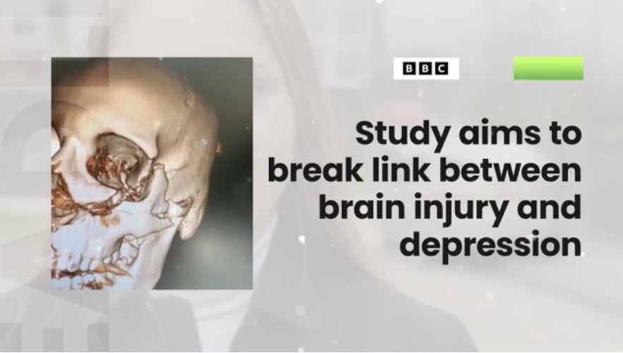 Preventing Depression After Brain Injury: A Reason for Hope