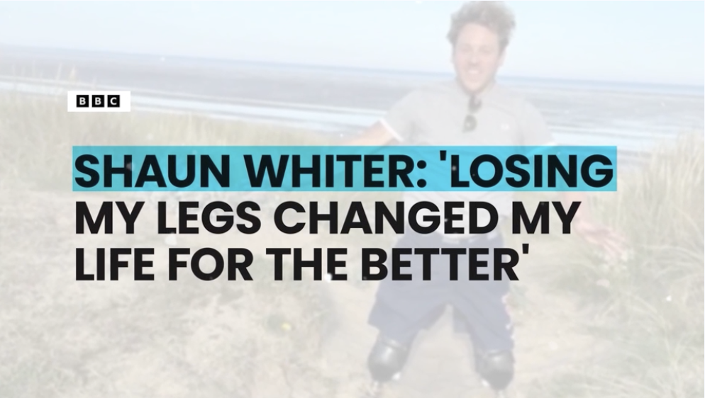 Shaun Whiter Runs A Marathon After Losing His Legs