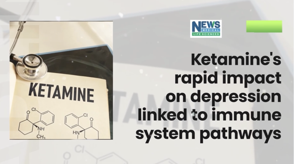 Ketamine’s New Path to Depression Relief